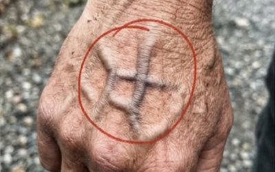 Si vos veines sont visibles, cela signifie que vous êtes… Voir plus